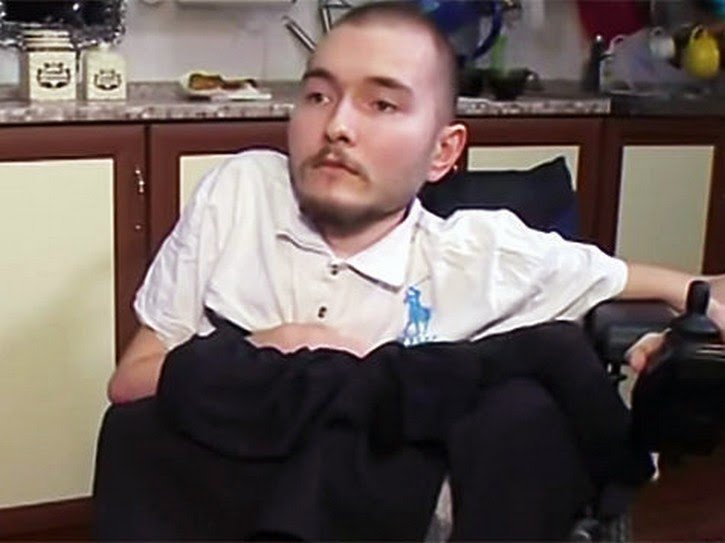 transplante_cabeca